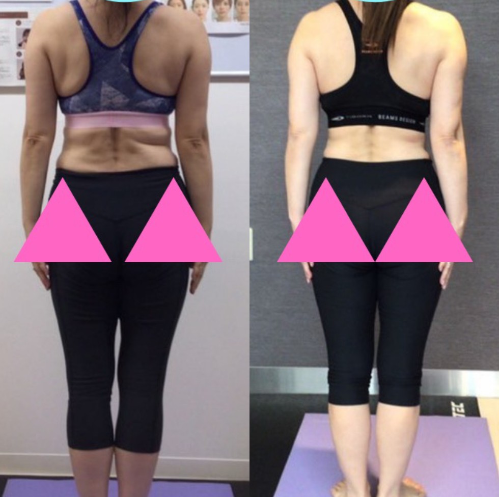 ビフォーアフター